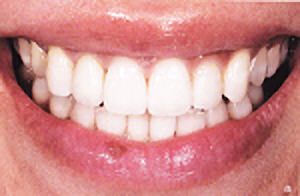 美しく健康的な印象になります