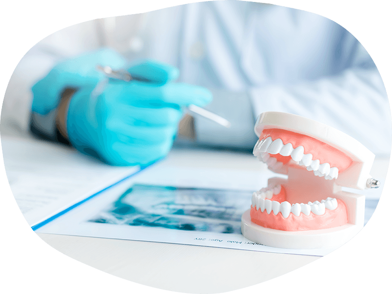 入れ歯治療は、患者様の口腔内の状態やご希望に合わせた最適な方法で行います。