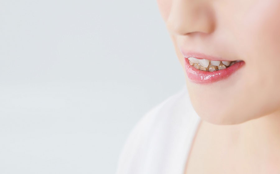 しおはま矯正歯科