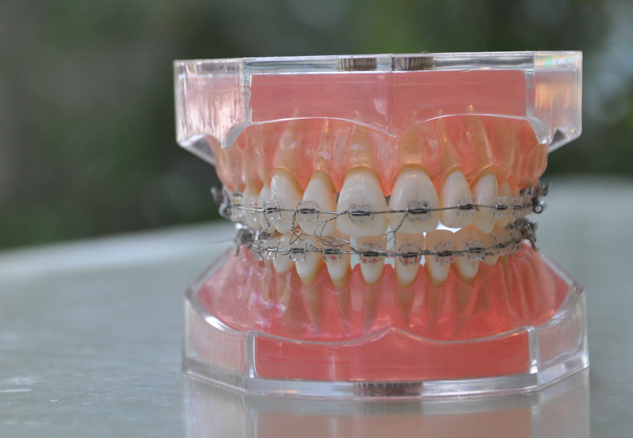 矯正治療を考えている方はご相談ください