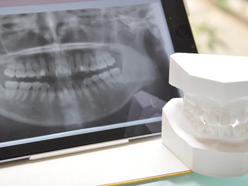 患者様への丁寧なカウンセリングを行い、噛み癖や生活習慣なども含めて原因を確認したうえで、治療方針を検討しています