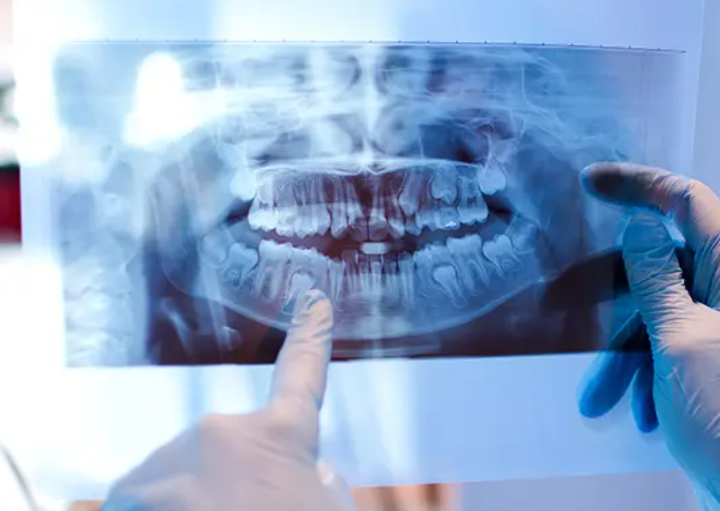 初期から重度まで、適切な処置と予防指導で健康な歯を維持