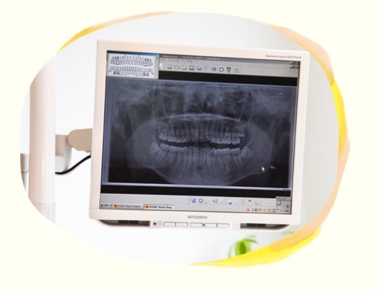 親知らずのお悩みはご相談ください