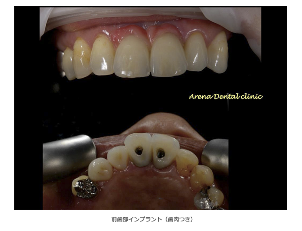 機能的で自然な噛み合わせを取り戻すサポートをしています