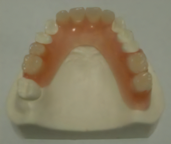 ミラクルデンチャーの一種 ミラクルフィット