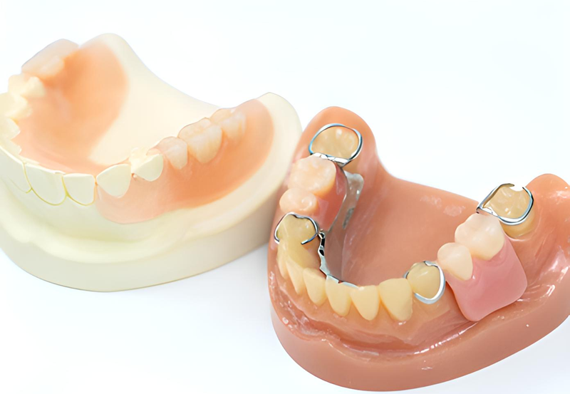 噛み合わせと装着感を重視した高品質な入れ歯で食事の楽しみを取り戻す