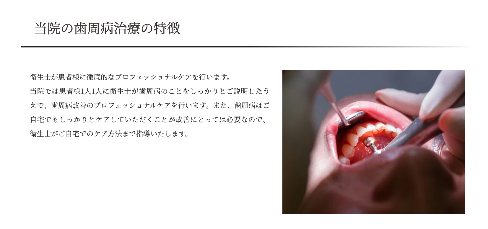 歯周病の早期発見と適切な治療に注力し、患者様が歯を健康に保てるよう支援しています