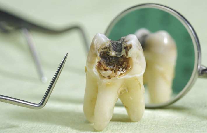 できる限り痛みを抑えた治療を心がけています