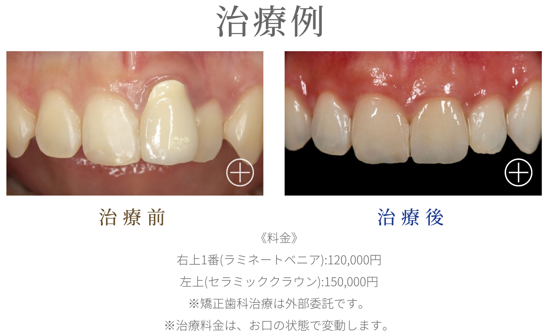 ご相談だけでもお気軽に神津デンタルオフィスまでお越しください