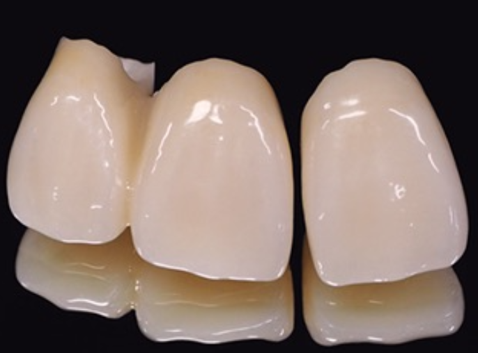 調和が美しいセラミック