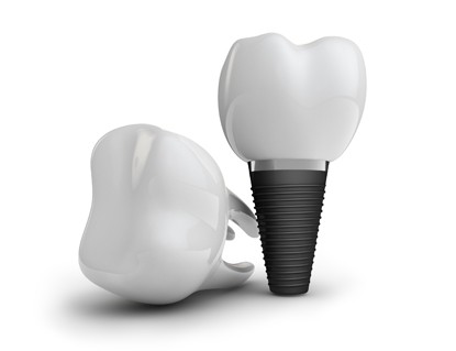 天然歯に近い噛み心地が得られます