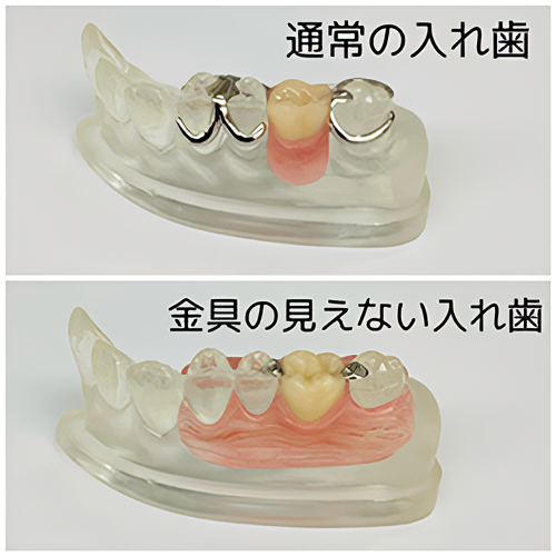 歯の喪失を放置せず、早めに歯科医院で相談することが大切です