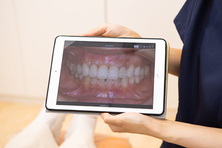 清潔感のある美しい口元を目指しましょう