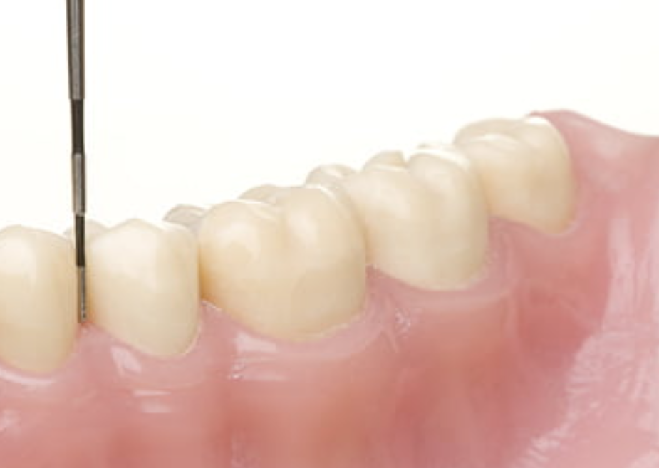 科学的根拠に基づいた最新の歯周病治療を提供