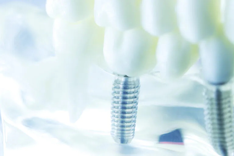 顎の骨の状態や神経の位置を正確に把握し、精密な診断と計画を基に治療を進めることが可能です