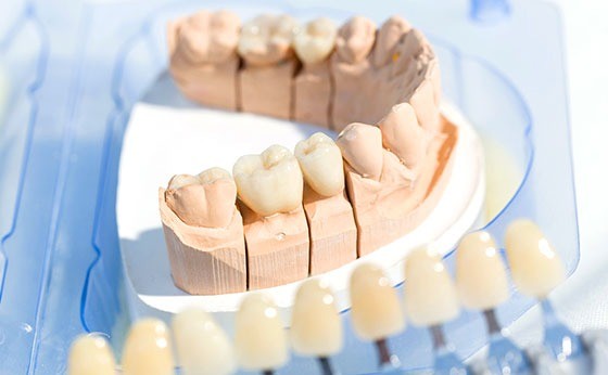 患者様のお悩みやご要望を丁寧に伺い、歯の形や色調が周囲と自然に調和するよう、歯科医師と歯科技工士が連携しながら治療方法を検討しています。