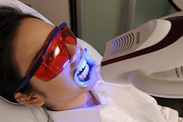 口元の美しさを引き出す審美治療