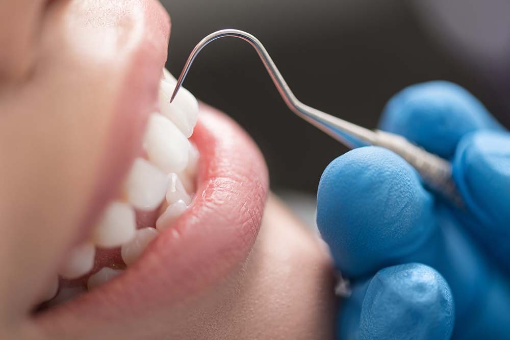 重度になるほど治療が難しくなるため、早期発見・早期治療が重要です