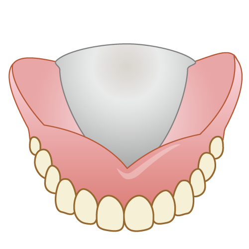 入れ歯
