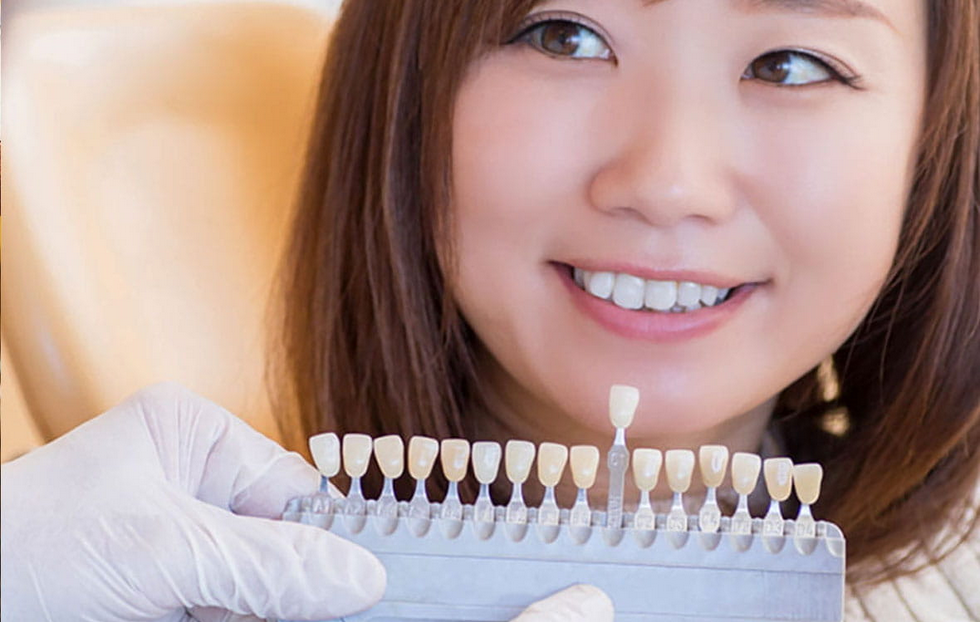 ご自宅でお手軽、簡単にできるホームホワイトニングもあります