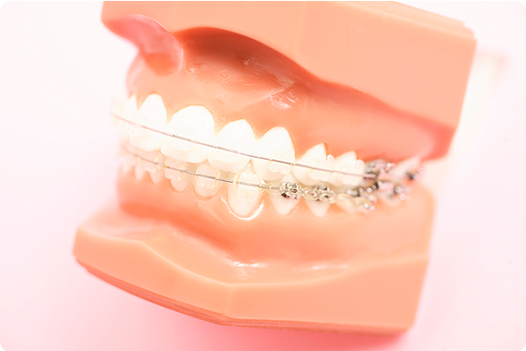 ブラケット矯正・MTM（部分矯正）を行っております。