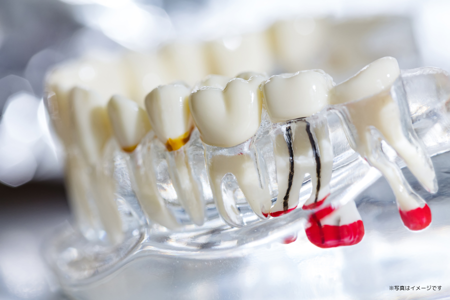 最新の歯科用CTを導入することで、院内での精密な診断と治療計画の作成が可能です