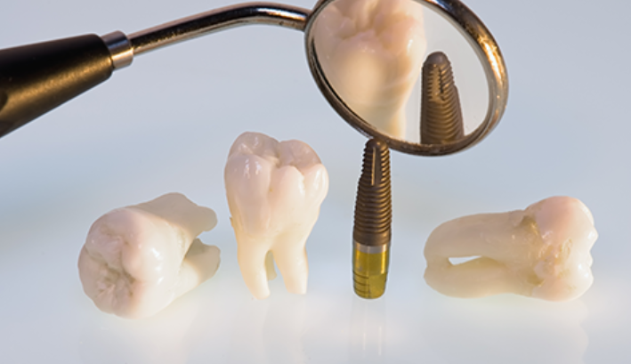 患者様の希望に合わせた治療を行います