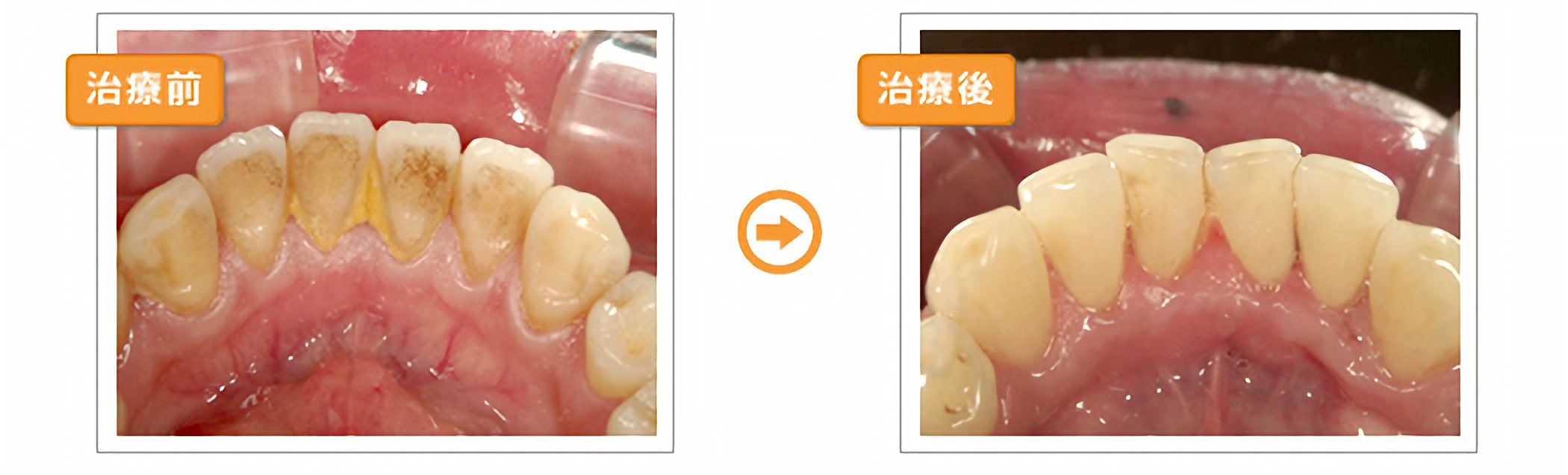 プロフェッショナルクリーニング