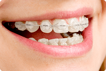 専門医が導く、理想の歯並びへ