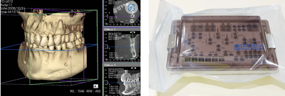 安全な治療をこころがけます