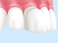 矯正治療やラミネートべニアなどを提供しています