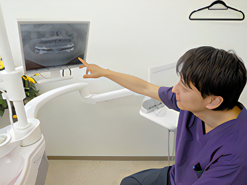 治療計画のご案内