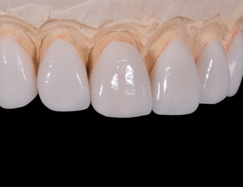 自分らしい口元へ