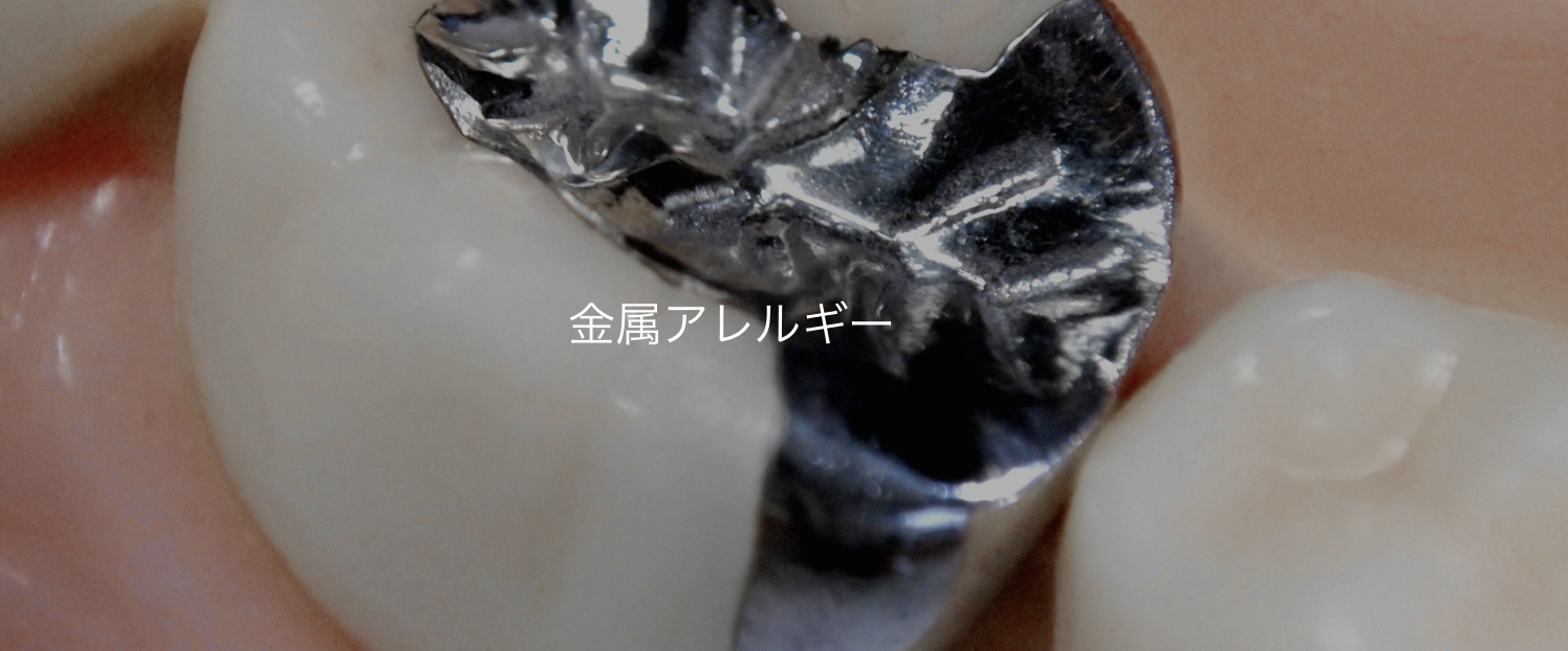 患者様が安心して治療を受けられるよう、一人ひとりの症状や状態に合わせた対応を心がけています