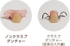 一見しただけでは入れ歯とほとんどわからないほど自然な見た目が特徴です