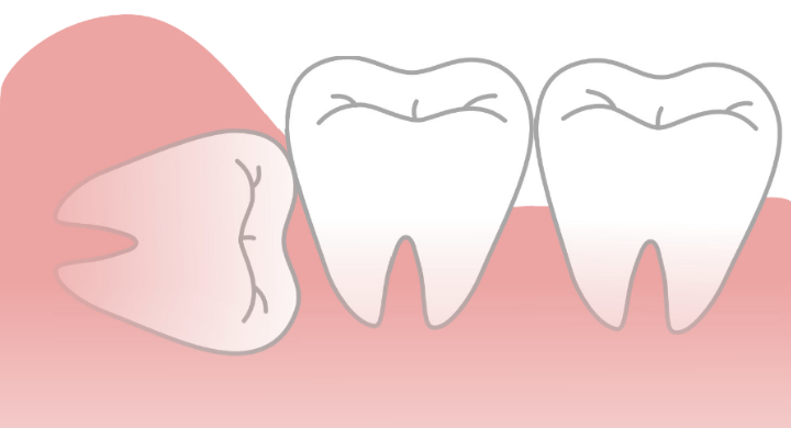 まざまな口腔内トラブルに対応する口腔外科治療を行っています