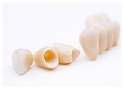 セラミックで自然な白さを