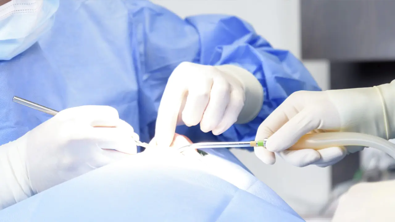 インプラント治療の成功率を高めるために、CTを活用した精密な診査・診断を行います