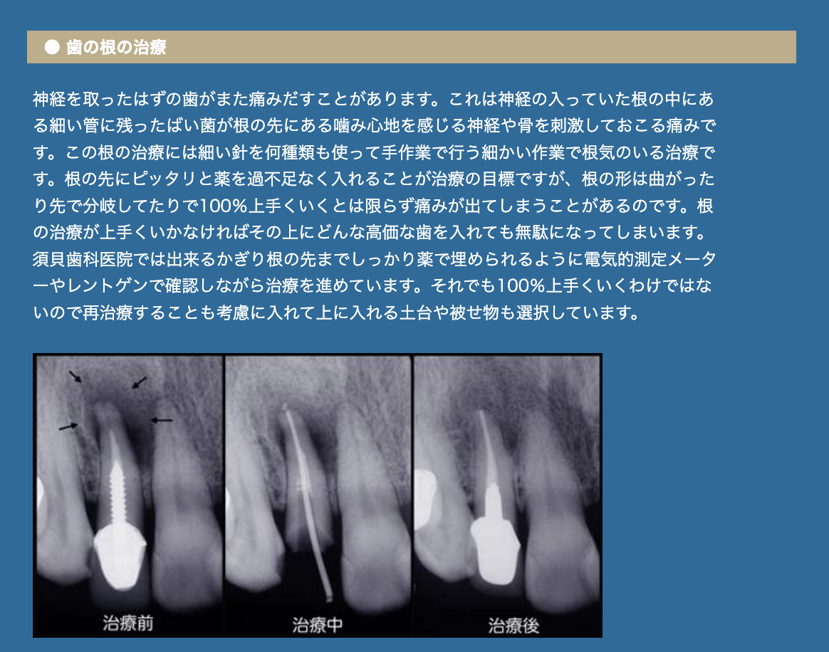 虫歯治療を通じて歯の健康を長く保つため、患者様の負担を最小限に抑える丁寧な治療を行っています