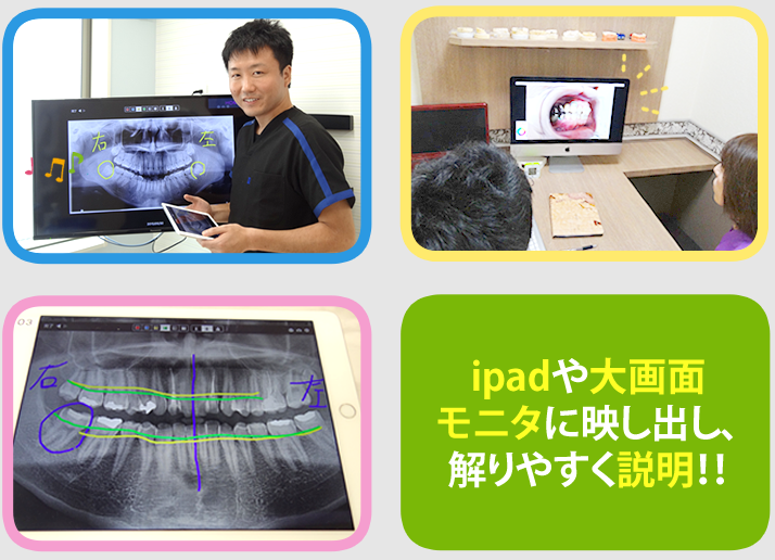 分かりやすい説明
