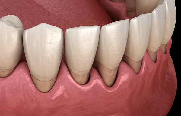 最新デジタル技術と豊富な実績で安全性と精度を両立するインプラント治療