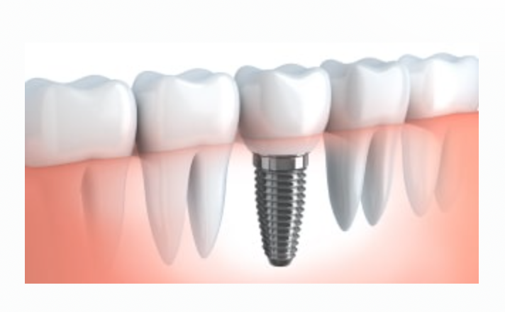 患者様の症状やお気持ちに沿った治療方法をご提案します