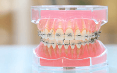 きれいな歯並びで健康と自信を手に入れましょう