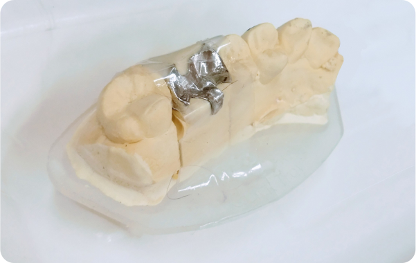 専門のスタッフが丁寧に対応して最適な治療法を提案します