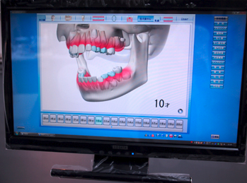 長期間にわたるケアが重要