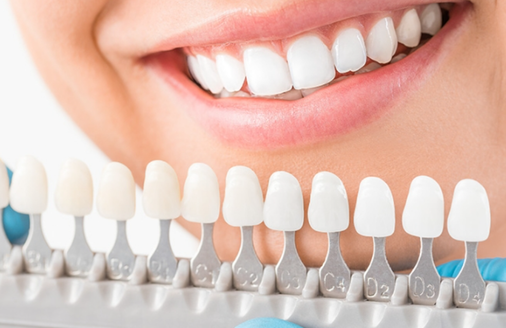 天然歯に近い自然な美しさと長期的な機能を実現する審美治療