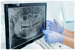 MTMはスウェーデンのカリオロジー（むし歯学）に基づいた医療プログラムです。