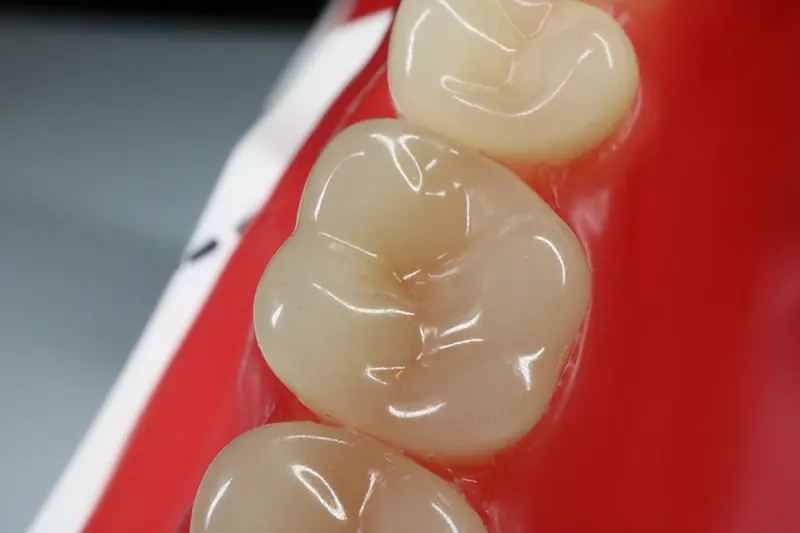 患者様の健康を第一に考え、可能な限り削らず、痛みの少ない治療を提供しています