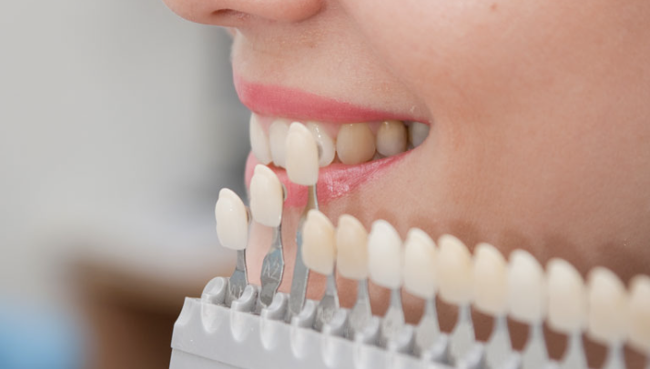 見た目の美しさだけでなく、機能性や口腔内の健康を考慮した審美治療を行っています