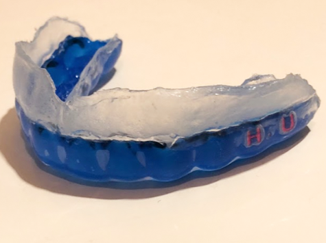 個々の目的に合わせたマウスガードづくりを行う治療法です